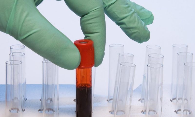 Mogelijke universele kanker bloedtest dankzij bacteriële DNA handtekening.