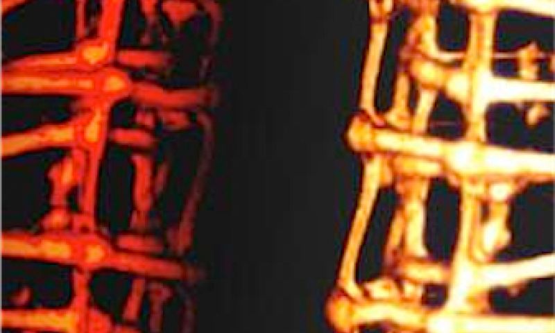 Mix levende cellen met elektronica en je kweekt een cyborg