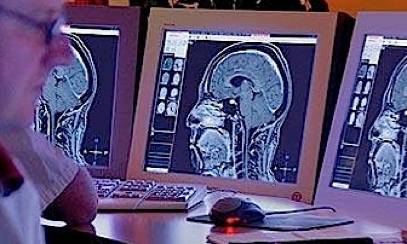 Intel ontwikkelt computer die gedachten leest