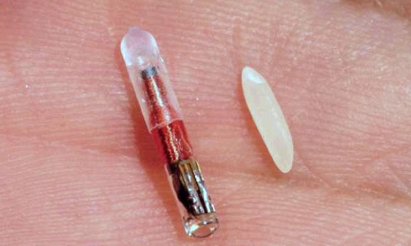 Nederlandse techjournalist test chip in zijn arm
