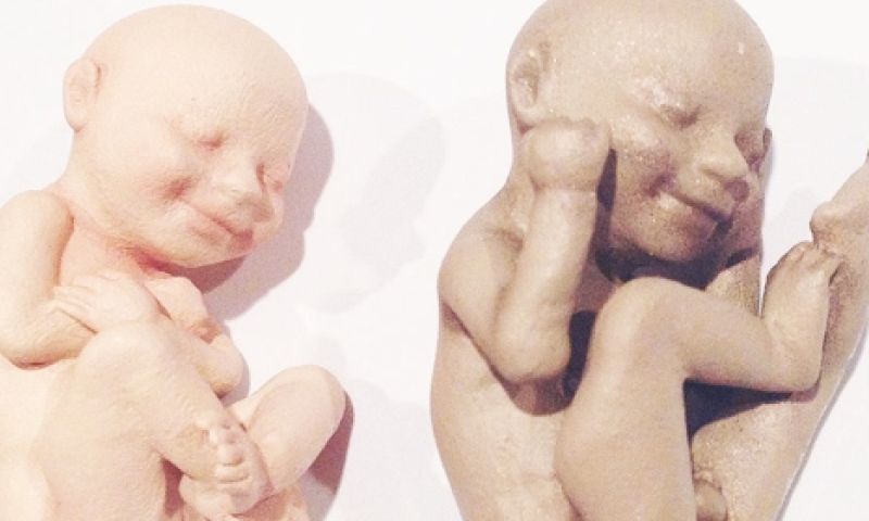 3d-geprinte foetus: nu al vasthouden wat in de buik zit