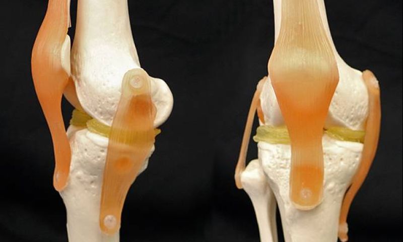 Nieuwe gel voor 3D-printen van nieuwe meniscus