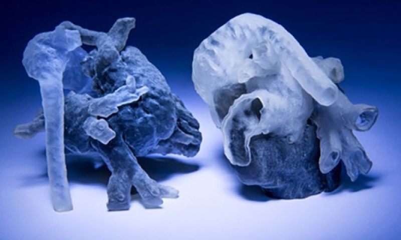 Artsen printen binnenkort een persoonlijk 3D-model van je hart