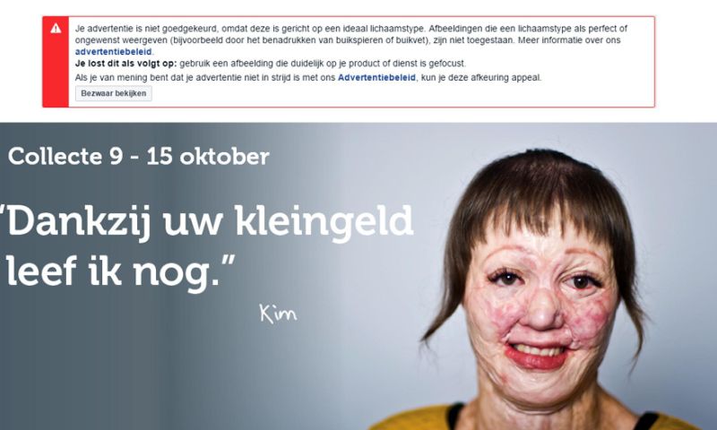Facebook weigerde advertentie brandwondenstichting