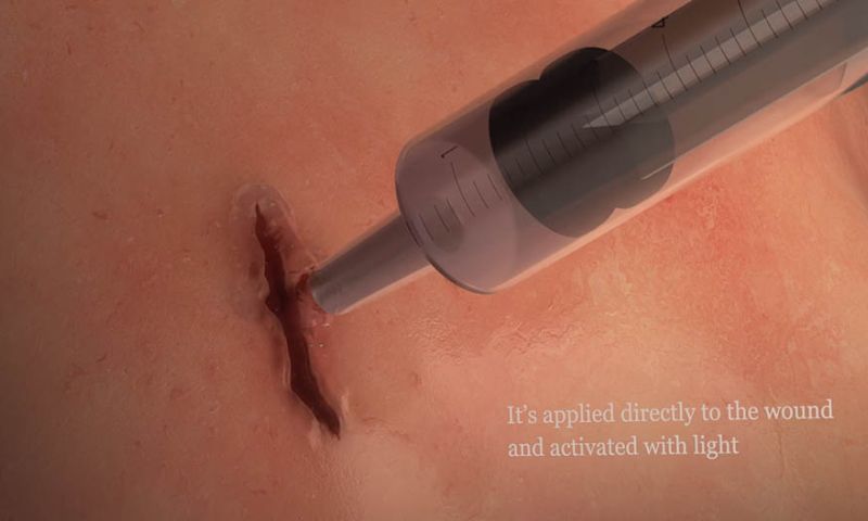 'Elastische lijm' dicht wonden in een minuut