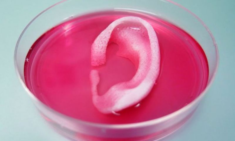 Dit 3D-geprinte oor kan straks een echt oor vervangen