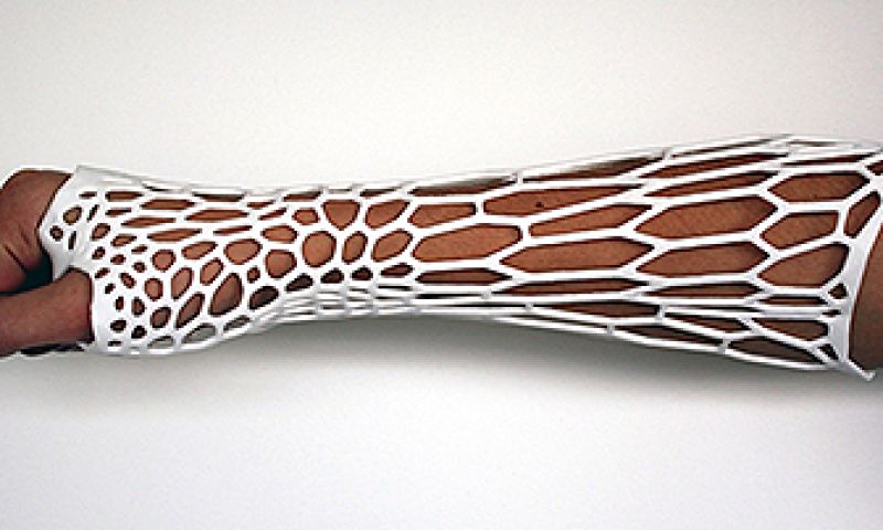 Creative class: Spiderman-huls vervangt gipsarm