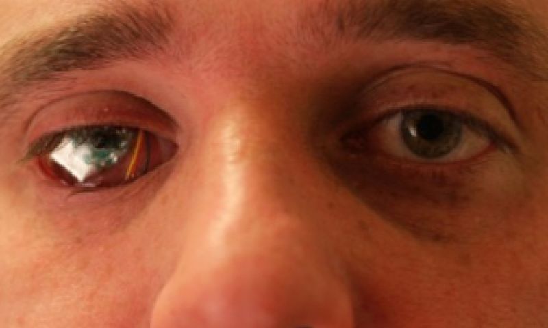 Eyeborg rust kunstoog uit met draadloze camera