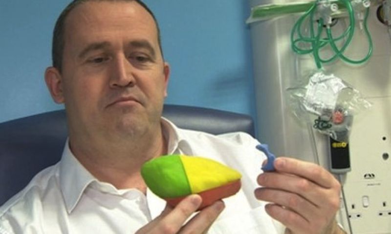 Patiënt helpt doktoren door zijn nier in 3d te printen