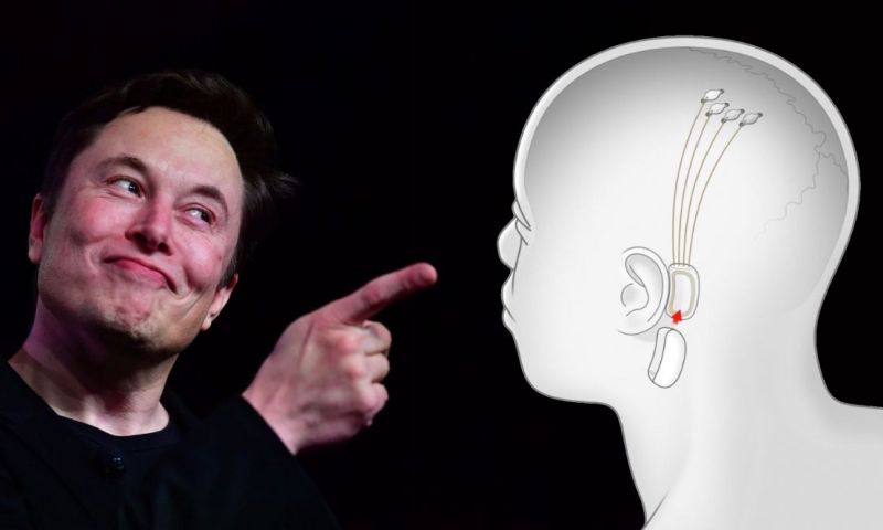 elon musk neuralink hersenimplantaat