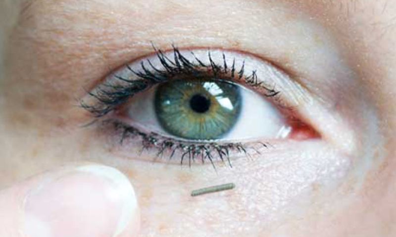 Nederlandse rivaal voor Google's oogsensor voor diabetici