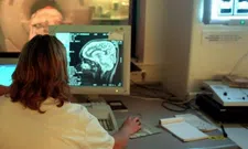 Thumbnail for article: Wetenschappers testen HD-hersensonde in menselijk brein