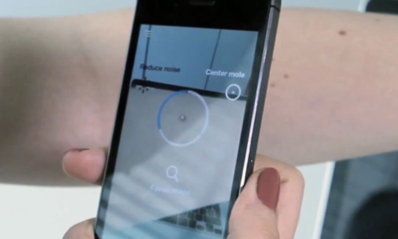 Ziekenhuizen testen Nederlandse huidkanker-app