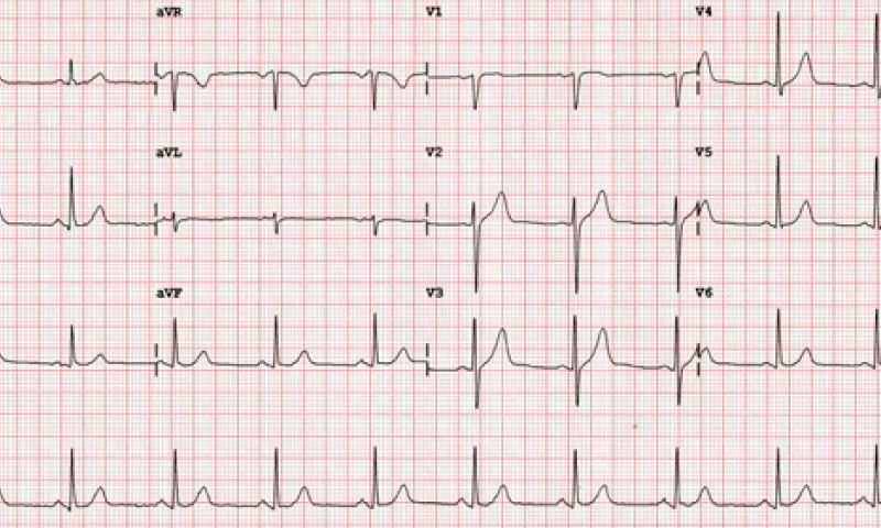 Je hartslag als wachtwoord