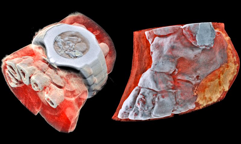 © MARS Bioimaging Ltd.