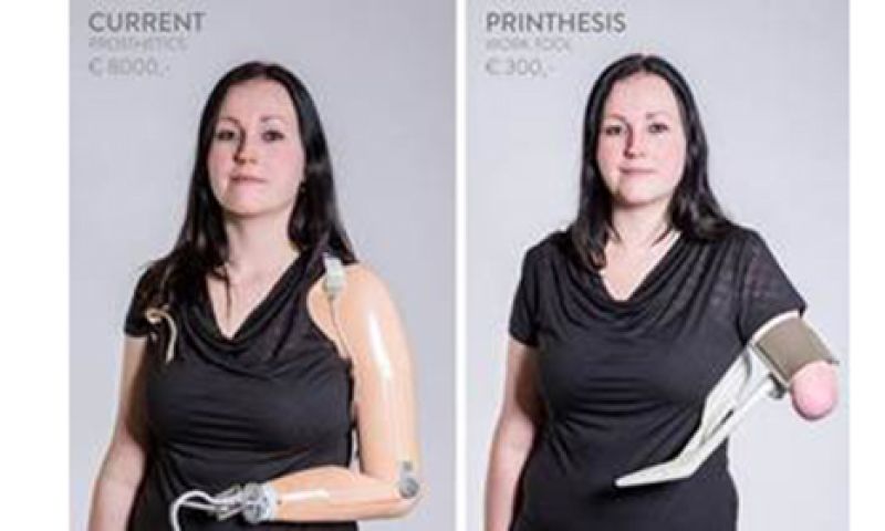 3D-geprinte armprothese wint Nederlandse James Dyson Award