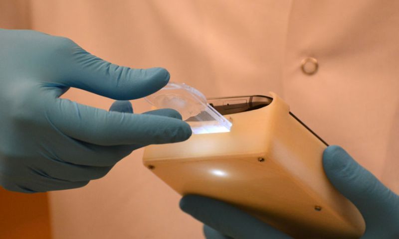 Test je sperma met je smartphone