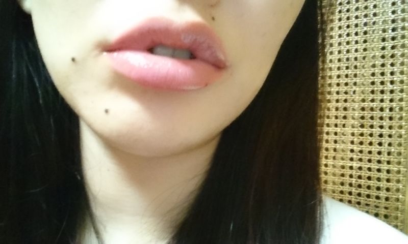 'Meer lipcorrecties door selfies'