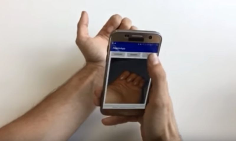 Smartphone app kan bloedarmoede detecteren