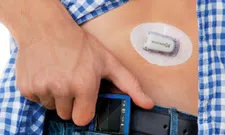Thumbnail for article: Google werkt aan piepkleine diabetes-sensoren