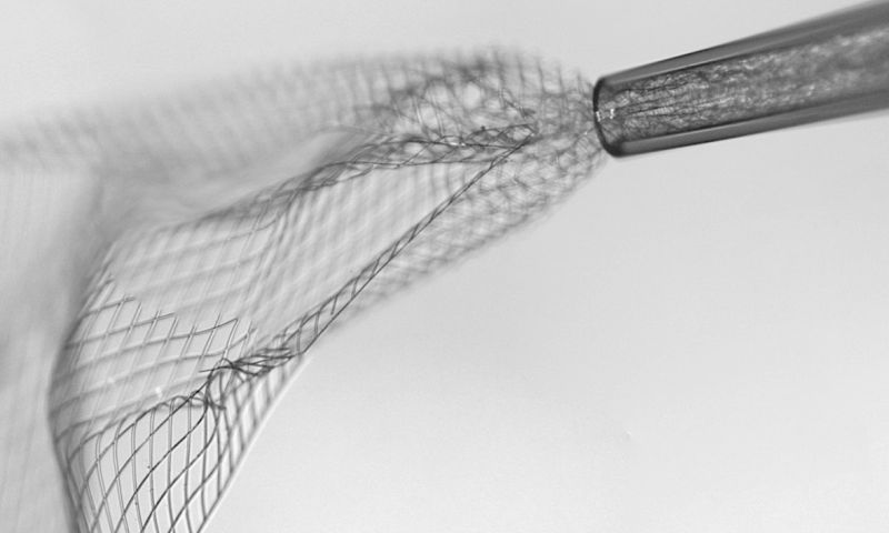 Geïnjecteerde draadjes kunnen Parkinsonpatiënten helpen