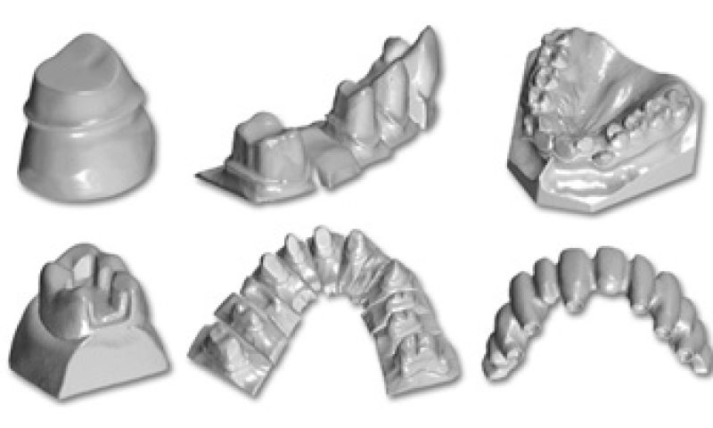 Bejaarde krijgt 3D-geprinte onderkaak