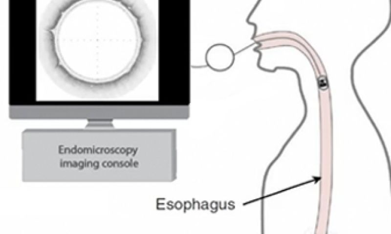 Inslikbare 3d-camera scant je slokdarm
