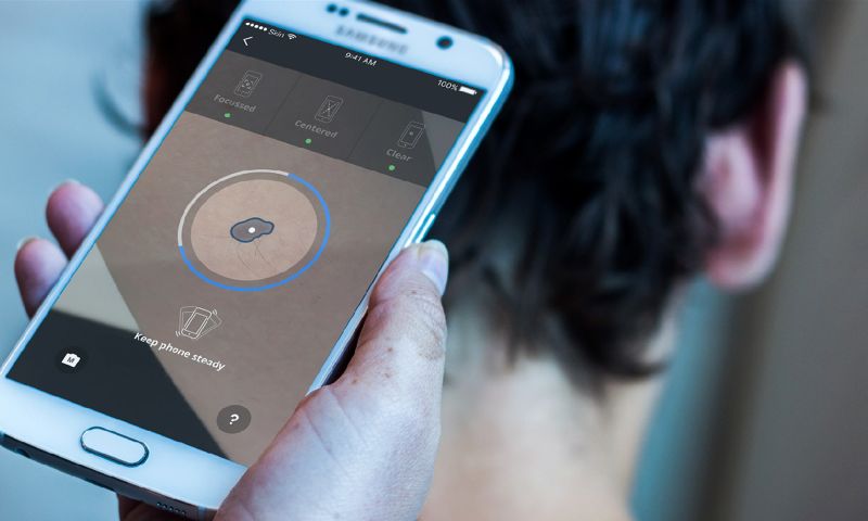 apps scannen huid plekjes verdacht plekje scan app