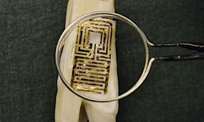 Draadloze kies monitort tandplak