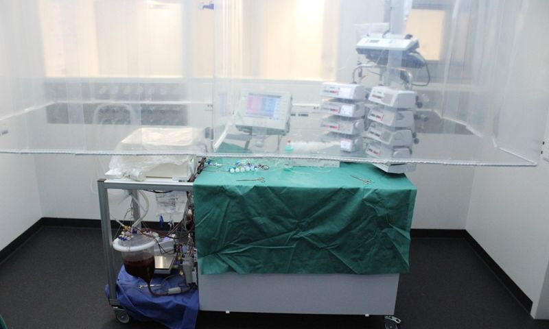 Nieuwe transplantatiemachine houdt levers één week goed