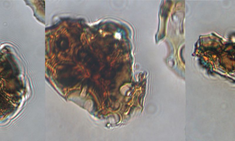 Dit wondermiddel lost 'papierzorgen' op