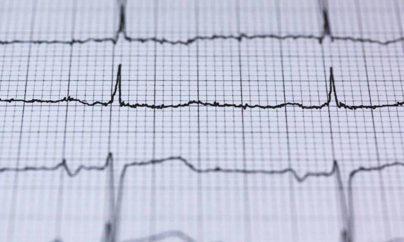 Hartslag-algoritme voorspelt of je binnen 30 dagen dood gaat