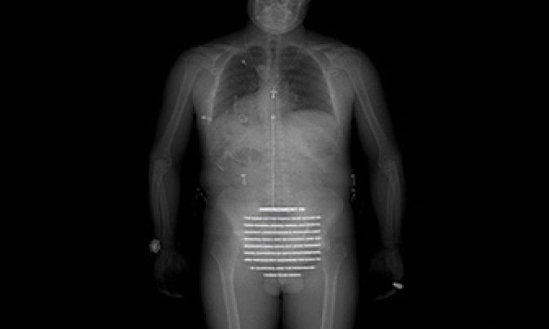 Bodyscan op luchthaven niet verplicht