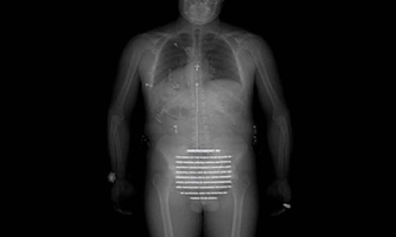 Scan(deer) je rechten