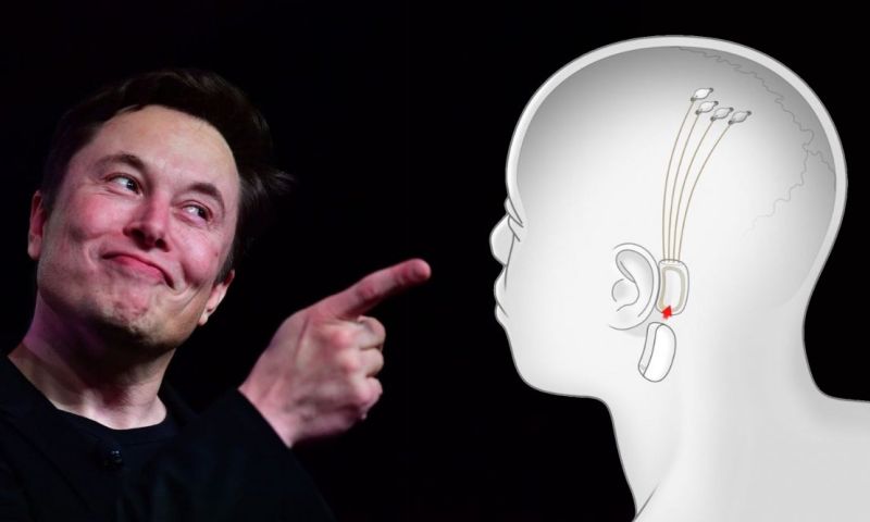 Bedrijf Elon Musk gaat hersenimplantaten bij mensen binnenkort testen