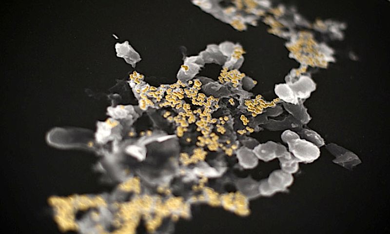 Goud maken met bacteriën