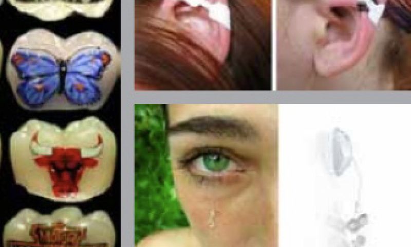 Infobesitas en elfenoortjes