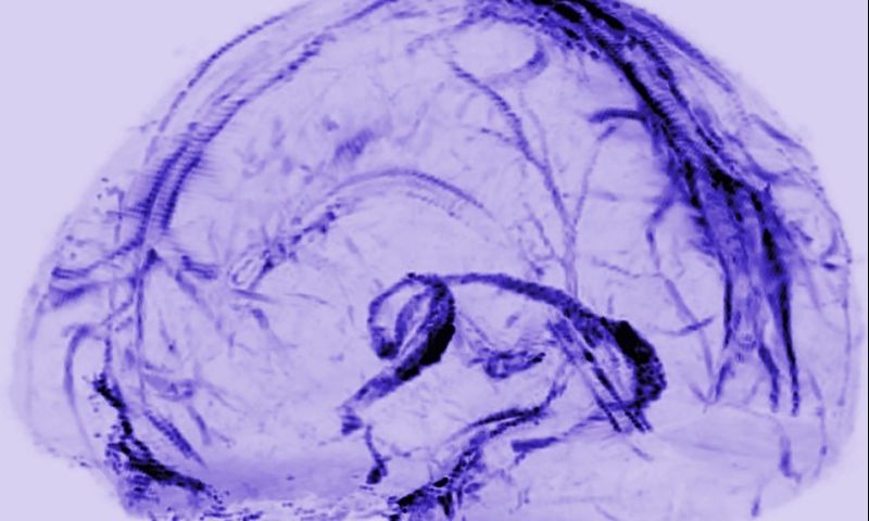 © Daniel Reich / National Institute of Neurological Disorders and Stroke