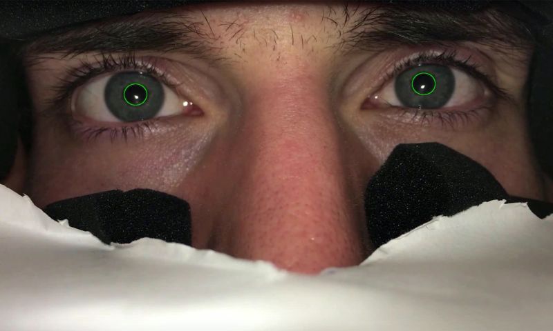 Video: deze app detecteert of je een hersenschudding hebt