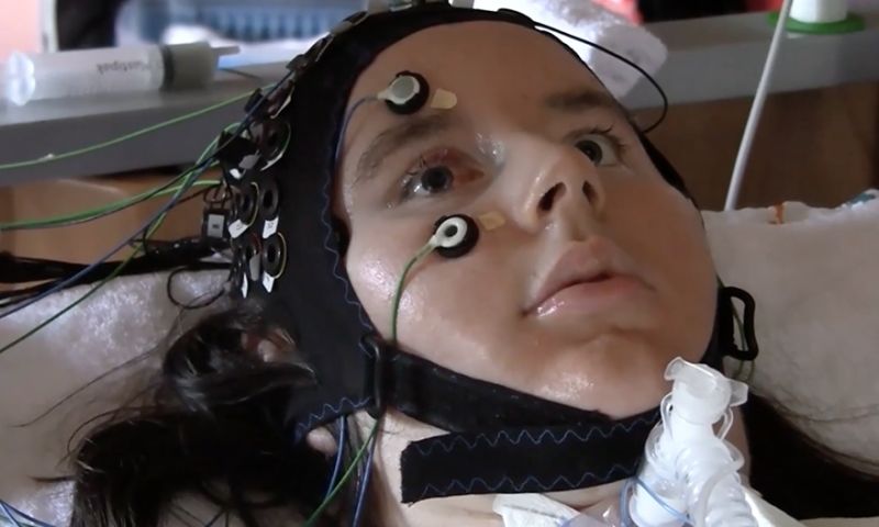 Hersenscanner is doorbraak voor verlamde patiënten