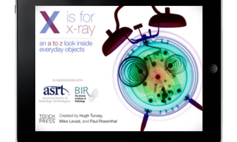 X is for X-Ray