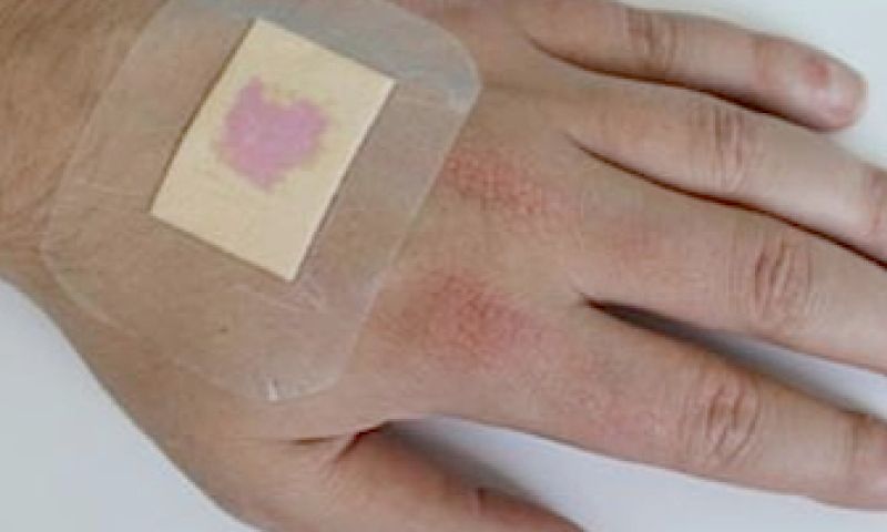 Pleister verandert van kleur bij ontsteking