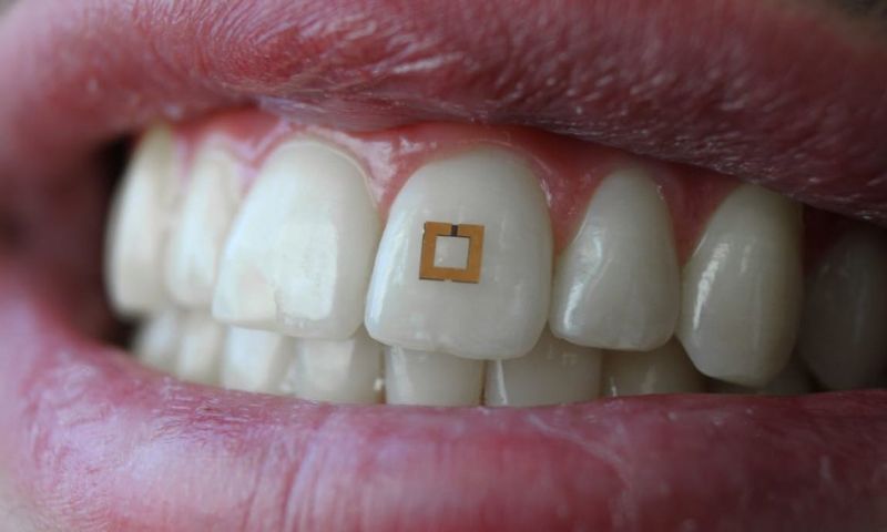 Deze tandsensor meet wat je binnenkrijgt