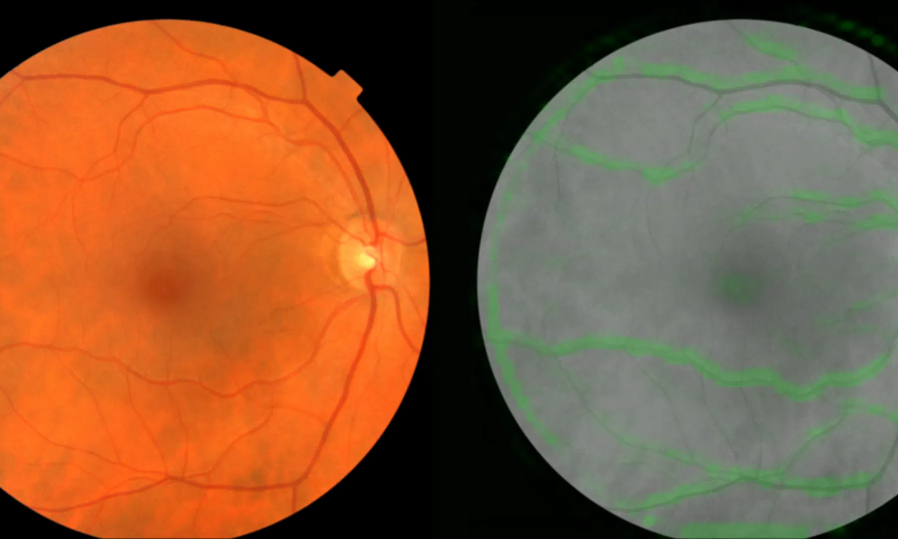 Google-algoritme kan hartproblemen voorspellen