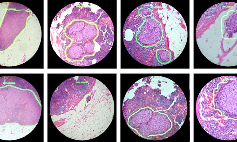 Microscoop Google traceert kankercellen in real-time