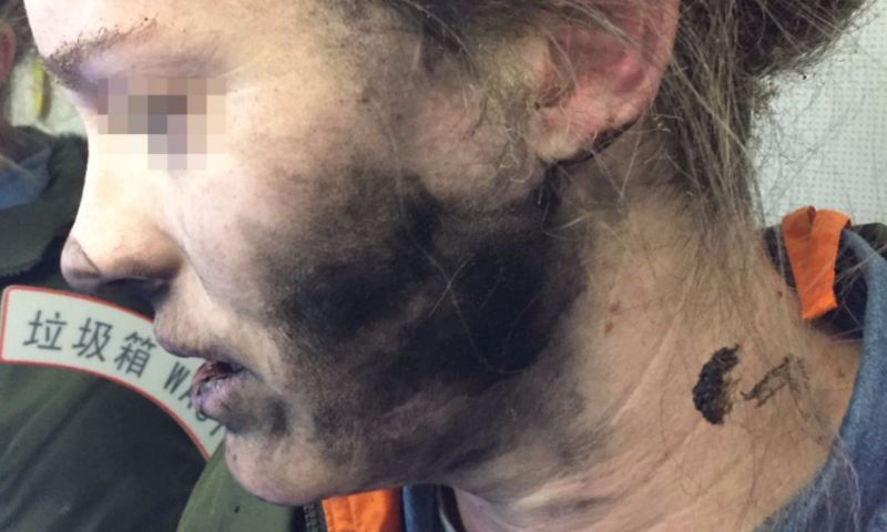 Koptelefoon van vrouw vliegt in brand in vliegtuig