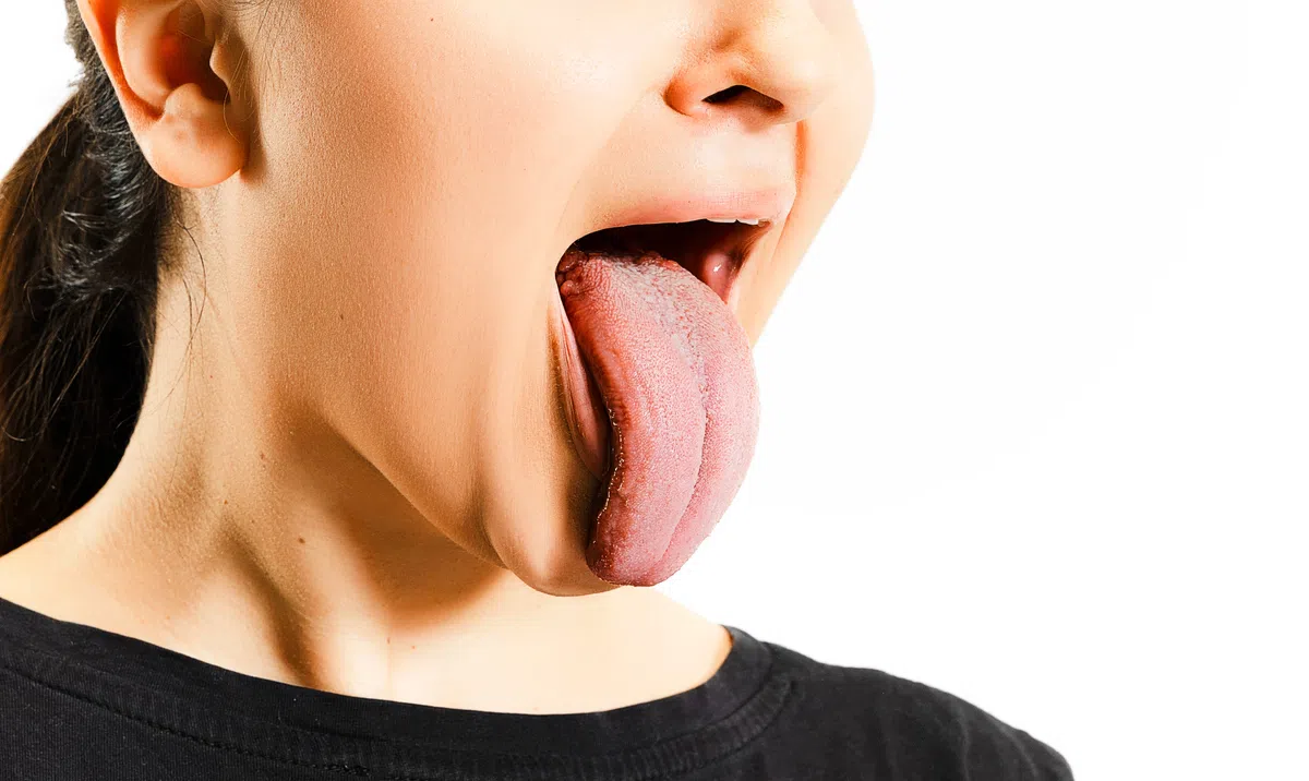 This AI Model Knows Exactly What Disease You Have By Looking At Your Tongue