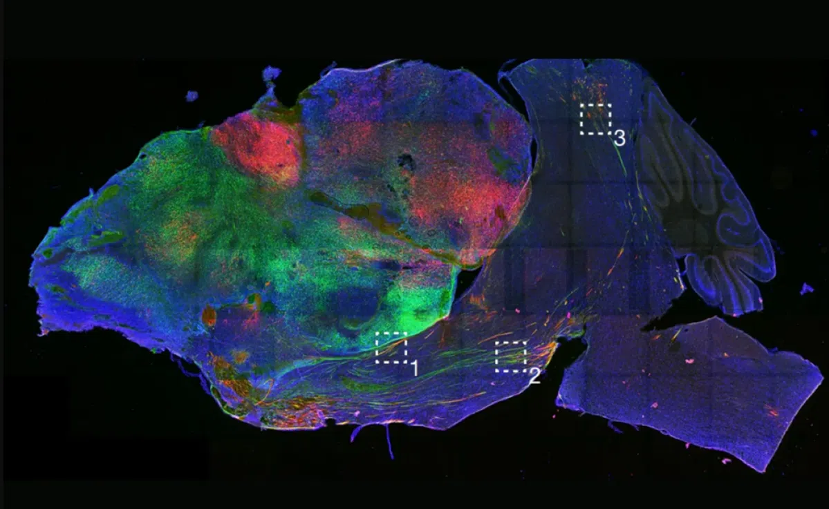 Human tissue replaces mouse cortex